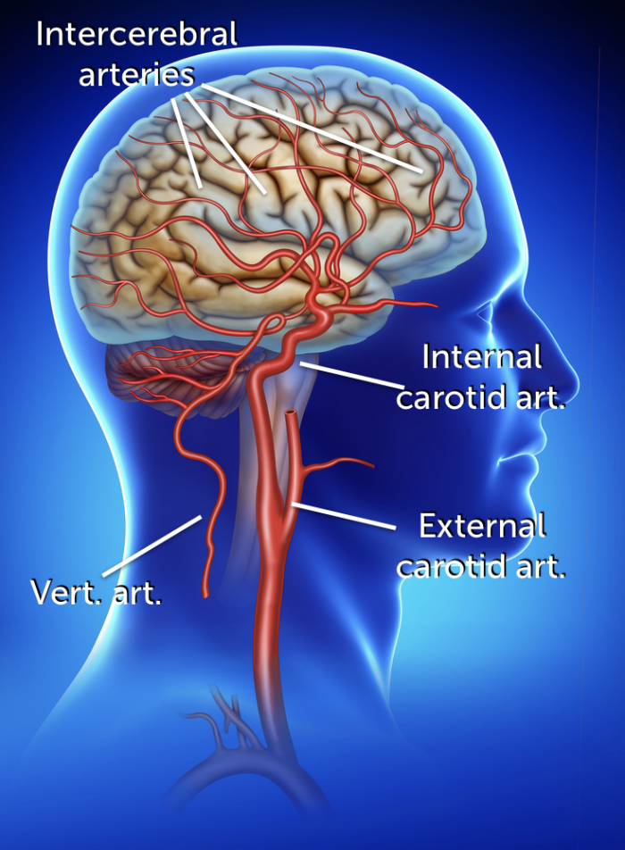 8-eca-vs-ica-external-versus-internal-carotid-artery-123-sonography